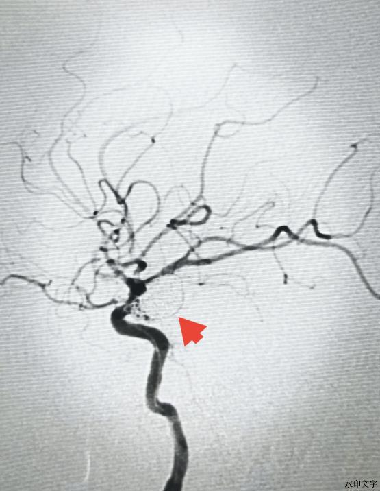 382f5f2835aeb70a3f9c09be9a78d0a