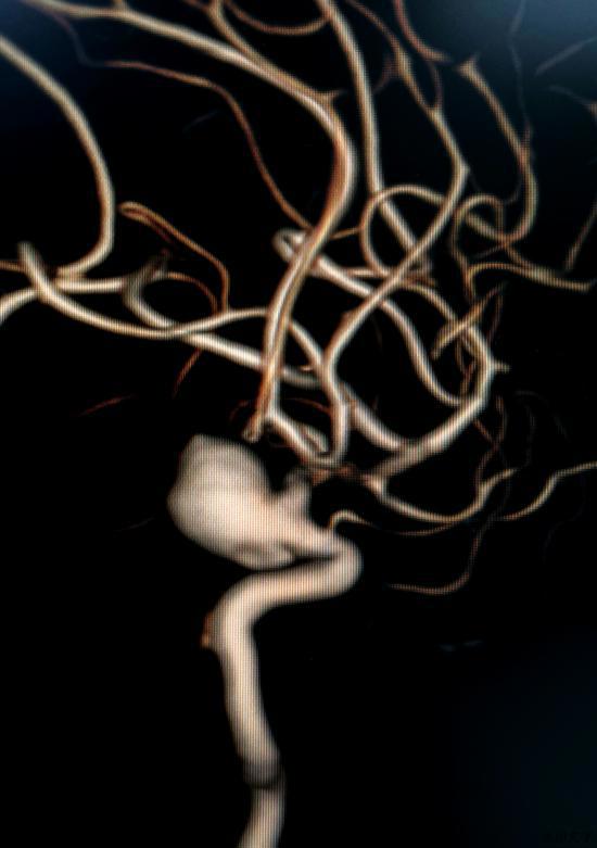 8f332c95739e867d1c8da42028b0d4a