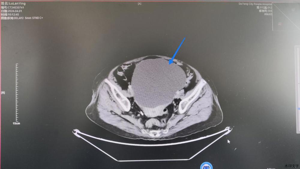 77e837832a375cee42ca9f156876557